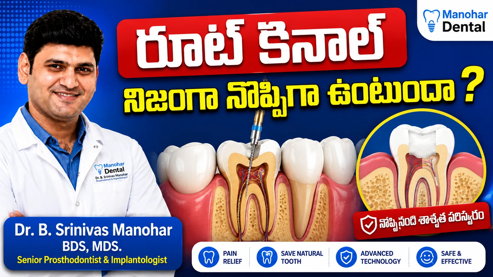 Root Canal Treatment video thumbnail